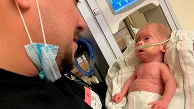 في حالة نادرة.. طفل رضيع يولد بسرطان في الكبد 