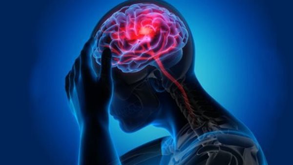 التشوهات الشريانية