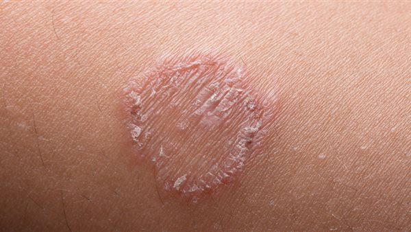 السعفة - أرشيفية