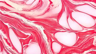 القاتل الصامت.. دراسة تكشف مخاطر دهون العضلات