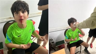 إعلامية شهيرة تحرر محضرًا يتهم 3 أشخاص بالتعدي على نجلها بنادي الصيد