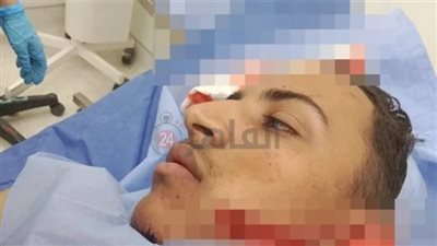 الداخلية تكشف تفاصيل إصابة طالب في مشاجرة مع زميله بشبرا الخيمة.. وتعلن القبض على المتهم