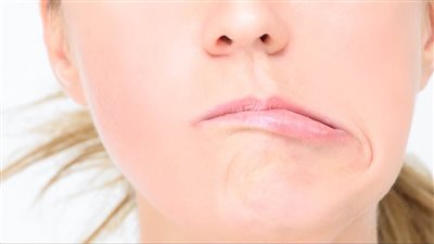 أسباب وأعراض الإصابة بالعصب السابع.. استشاري مخ وأعصاب يوضح