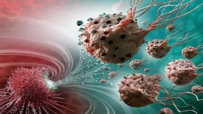 5 أعراض خطيرة تشير إلى الإصابة بالسرطان