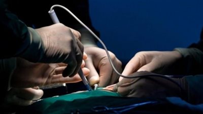 التهاب السحايا.. وفاة الحالة الرابعة في تكساس بسبب عدوى دماغية مرتبطة بالجراحة التجميلية 