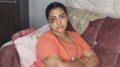 خانني بعد 3 أيام زواج.. سيدة تستغيث من بطش زوجها: أهله كسروا رجلي عشان طلبت حقي
