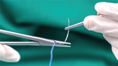 باحثون يطورون خيوطًا ذكية يمكنها إيصال الأدوية أو الشعور بالالتهابات| دراسة 