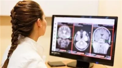 استخدام الذكاء الاصطناعي لتشخيص السرطان في أقل من 30 ثانية 