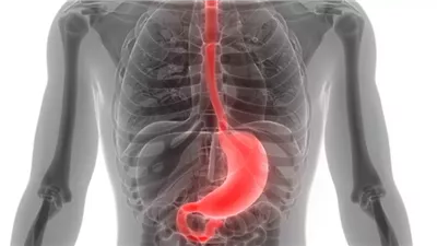 أطعمة تساعد في التغلب على اضطراب المعدة.. تعرف عليها 