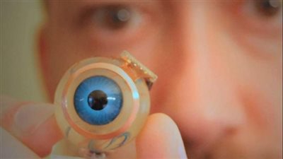 أجرى 8 عمليات جراحية.. أم تستغيث لتركيب عين صناعية لنجلها بعد انفجار الأصلية إثر حادث: بقالي 6 سنين بجري بيه