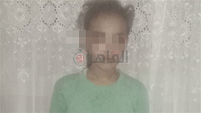 تعذيب على يد زوج الأم.. ننشر التقرير الطبي المبدئي للطفلة جومانا بعد هروبها لـ قنا