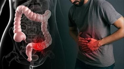 ‎3 طرق للوقاية من الإصابة بالإمساك.. تعرف عليها 