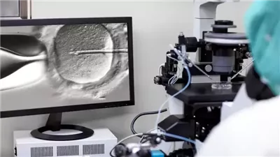 دراسة: التلقيح الاصطناعي المدعوم بالذكاء الاصطناعي سيزيد من معدلات نجاح الحمل