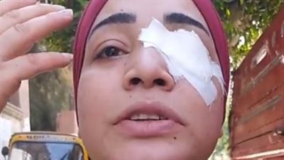 المتهمة بفقء عين ممرضة مستشفى شبرا العام: كنت عايزة أطمن على بنت عمي 