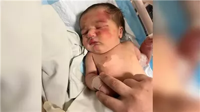 وجدها في كيس قمامة.. كلب ضال يعثر على طفلة بعد تركها في سلة مهملات بـ لبنان