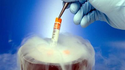 خبراء يوضحون العمر الأنسب لتجميد البويضات .. تعرف على التفاصيل 