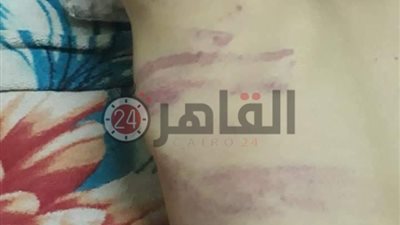 بسبب ثمرة من حديقة.. عامل يعذب طفل بعد ربطه بشجرة فى سوهاج