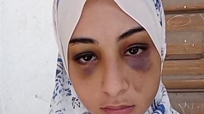 فتاة ببورسعيد تستغيث من بطش أعمامها: قيدوني بسلاسل حديد وضربوا جدي | بث مباشر