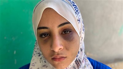 فتاة ببورسعيد قيدها أعمامها بالسلاسل: عاوزين يموتوني أنا وجدي | صور وفيديو