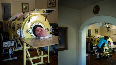 بسبب شلل الأطفال.. أمريكي يعيش داخل رئة حديدية لمدة 70 عاما ويرفض استبدال الجهاز