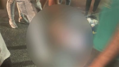 إصابة سيدة صدمتها سيارة أثناء عبورها طريق المحور