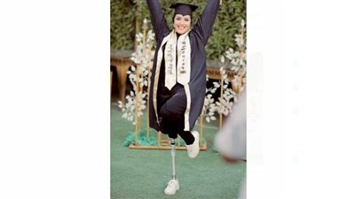 أصيبت في حادث وأصرت على استكمال دراستها.. طالبة الطرف الصناعي في حفل التخرج: الرضا هون عليّا الابتلاء