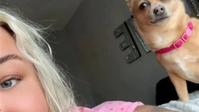 مهددة بعدم القدرة على الحركة.. سيدة تتهم كلبها الصغير بالتسبب في كسر قدمها