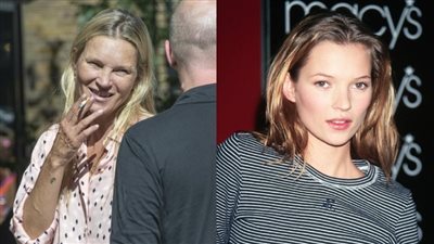 محبو عارضة الأزياء كيت موس مندهشون من سوء مظهرها.. والسبب التدخين