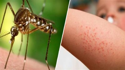 الصحة الأمريكية تحذر من ارتفاع وفيات حمى غرب النيل