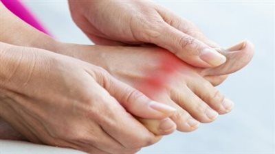 أطعمة تساعد على علاج وتخفيف أعراض النقرس