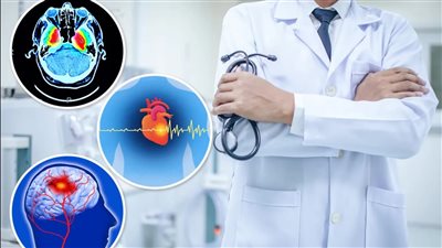 أبرزها النوبة القلبية.. 3 حالات مرضية يتم تشخيصها بشكل خاطئ