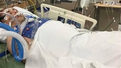 يلقبوه بالبطل الخارق.. شاب ينجو من الموت 8 مرات بعد تعرضه لوعكة صحية 