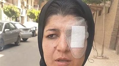 ممرضة السلام بعد فقء عينها: بقيت عورة عشان رفضت جاري يبيع مخدرات قدام بيتي | فيديو