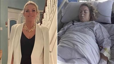 سيدة تخضع لاستئصال الطحال نتيجة خطأ طبي إثر إجراء عملية تكميم في تركيا