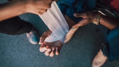 دراسة: الجلد المطبوع حيويًا يظهر نتائج واعدة في علاج الحروق والجروح الشديدة