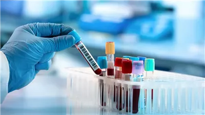 ما هي اختبارات الدم الأساسية للكشف عن علامات الالتهاب في الجسم؟