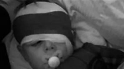 العصا السحرية كادت تصيب ابنهما بالعمى.. والدان يرفعان دعوى ويطالبان بـ 8 ملايين دولار من الشركة المنتجة لـ هاري بوتر