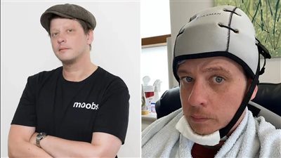 عانى من آلام في العضلات.. إصابة شاب بحالة مرضية نادرة تصيب النساء 