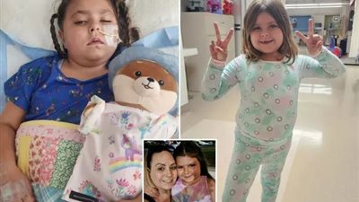 فصل نصف دماغها أثناء الجراحة.. إصابة صغيرة في كاليفورنيا بورم نادر