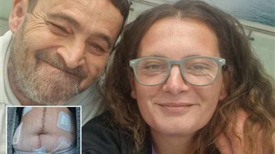 سيدة بريطانية تطعن نفسها بسبب حالة وراثية نادرة.. تعرف على مرض هنتنغتون