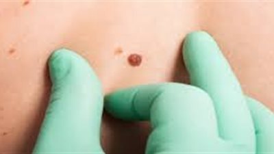 بعد خضوعها للعلاج لمدة عامين.. بريطانية تتفاجأ بعدم إصابتها بالسرطان 