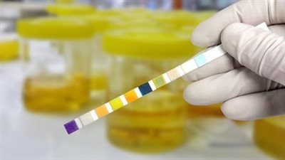 ابتعدي عن هذه المنظفات.. علاج التهاب البول والمهبل في المنزل بتعليمات هامة