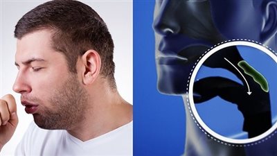 أفضل علاج للكحة بجميع أنواعها.. معلومات لن تتخلى عنها طوال الشتاء