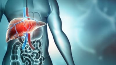 3 مشروبات صحية لمرضى الكبد الدهني .. تعرف عليها 