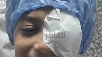 ابني فقد عينه وعايز حقه.. ولي أمر يستغيث بسبب إهمال إدارة مدرسة بالجيزة