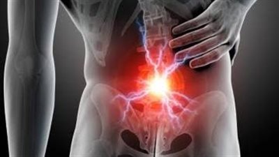 الرعاية الصحية تعلن عن حزمة العلاجات الطبيعية للانزلاق الغضروفي بمستشفيات التأمين الصحي الشامل