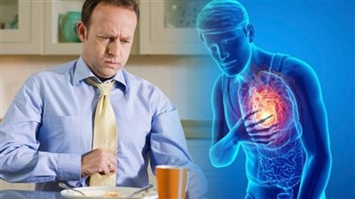 علاج حرقان المعدة في المنزل طبيعيا.. 20 خطوة فعالة للتخلص من الحموضة