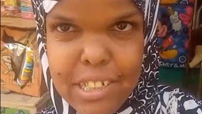 قصة كفاح فتاة من قصار القامة تعمل بكشك بقالة بالدقهلية: بخاف أتعامل مع الناس وبيتنمروا على شكلي| بث مباشر 