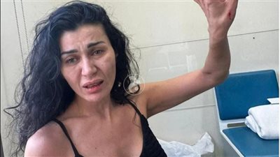 راضية بحكمك يا الله.. أول تعليق من نادين الراسي بعد تعرضها للضرب من شقيقها 