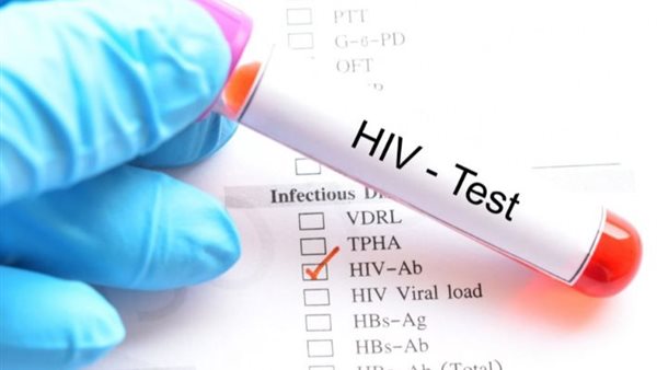 فيروس نقص المناعة